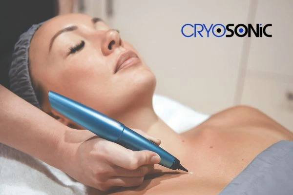Cryosonic lesion removal prices book today! Plymouth