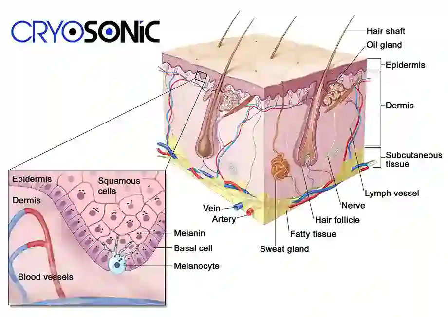 How Cryotherapy Stimulates Melanocyte Activity  Plymouth